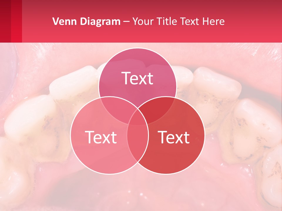 A Close Up Of A Tooth With Molds On It PowerPoint Template