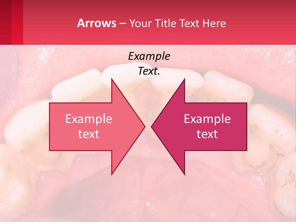 A Close Up Of A Tooth With Molds On It PowerPoint Template