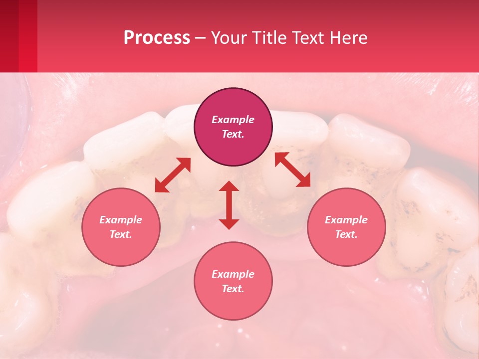 A Close Up Of A Tooth With Molds On It PowerPoint Template