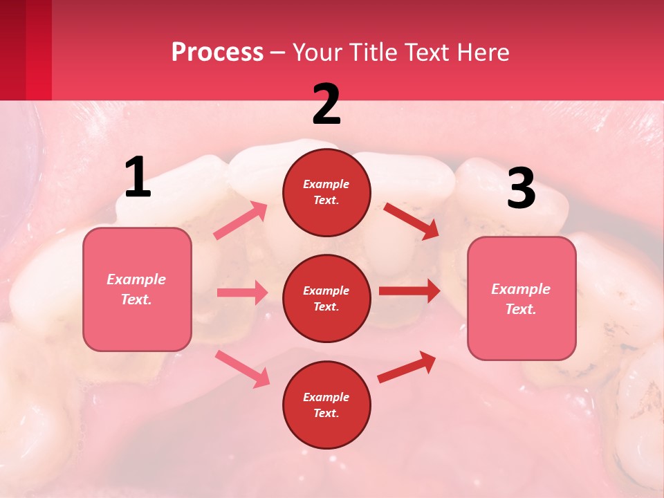 A Close Up Of A Tooth With Molds On It PowerPoint Template