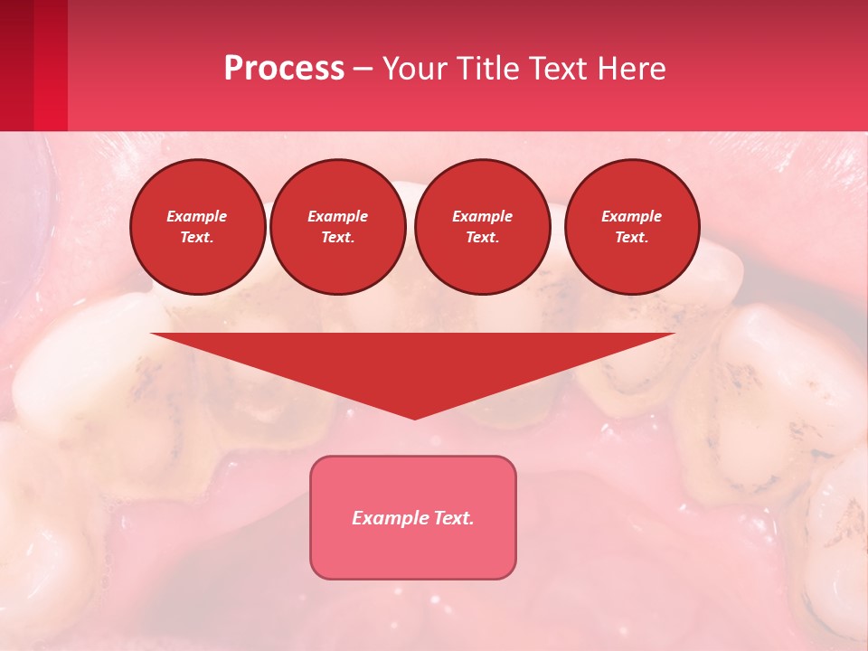 A Close Up Of A Tooth With Molds On It PowerPoint Template