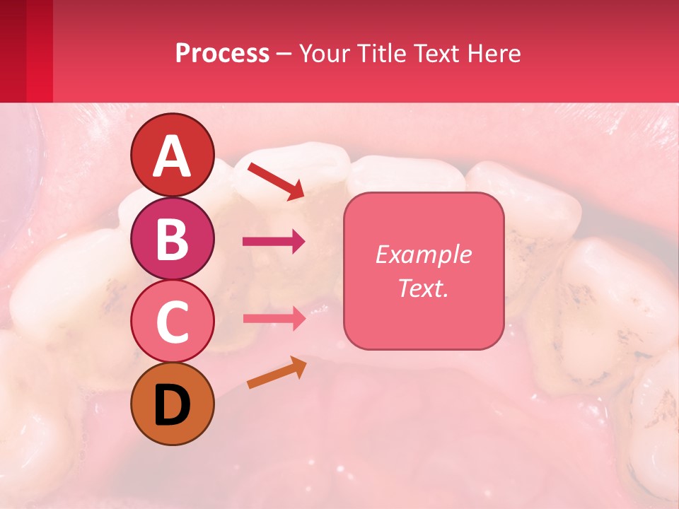 A Close Up Of A Tooth With Molds On It PowerPoint Template