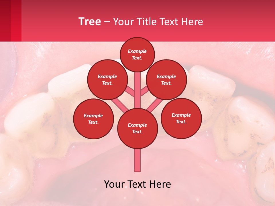 A Close Up Of A Tooth With Molds On It PowerPoint Template