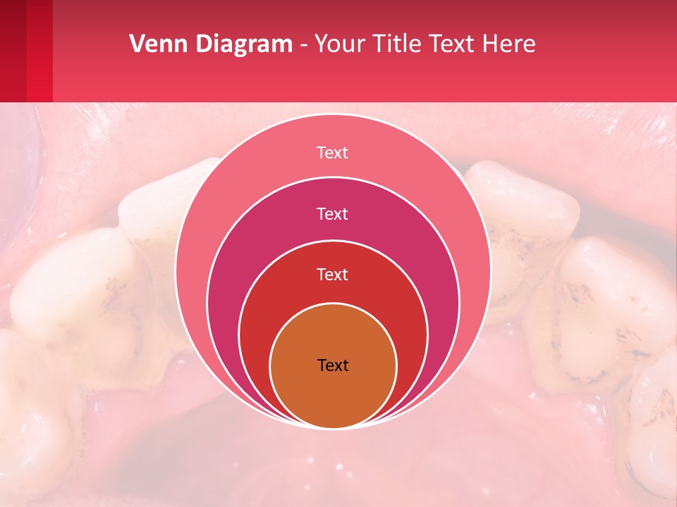 A Close Up Of A Tooth With Molds On It PowerPoint Template