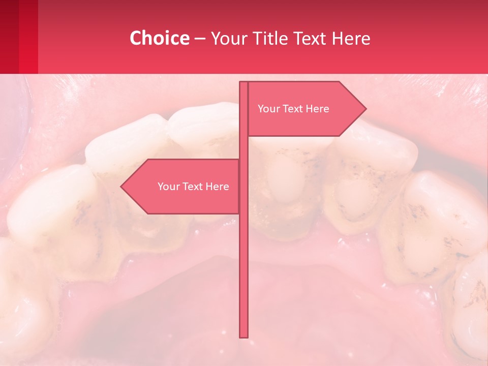 A Close Up Of A Tooth With Molds On It PowerPoint Template