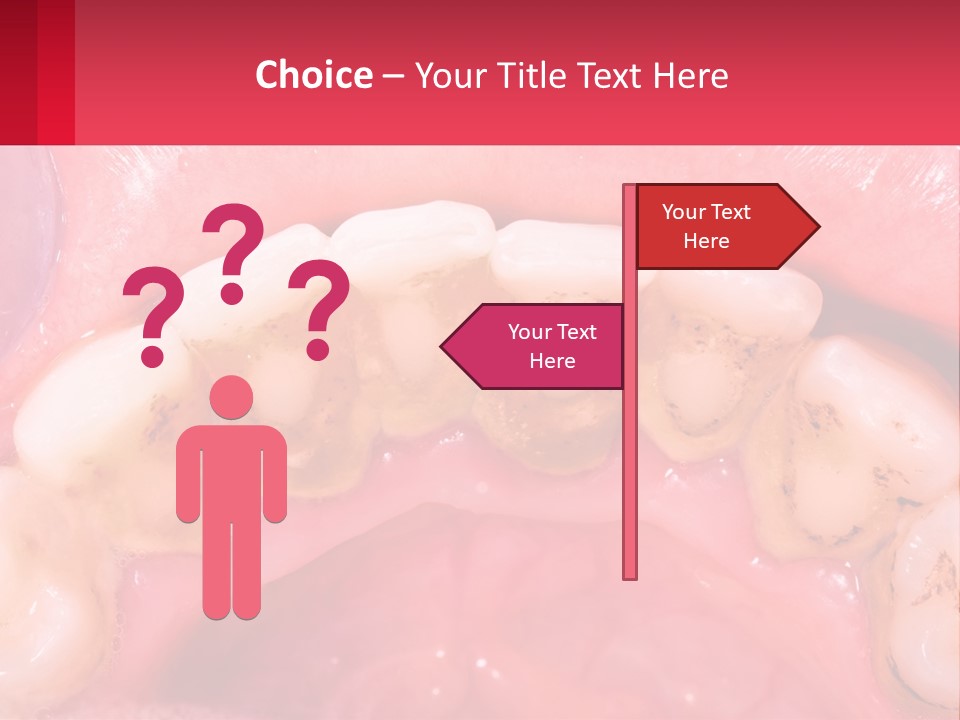 A Close Up Of A Tooth With Molds On It PowerPoint Template