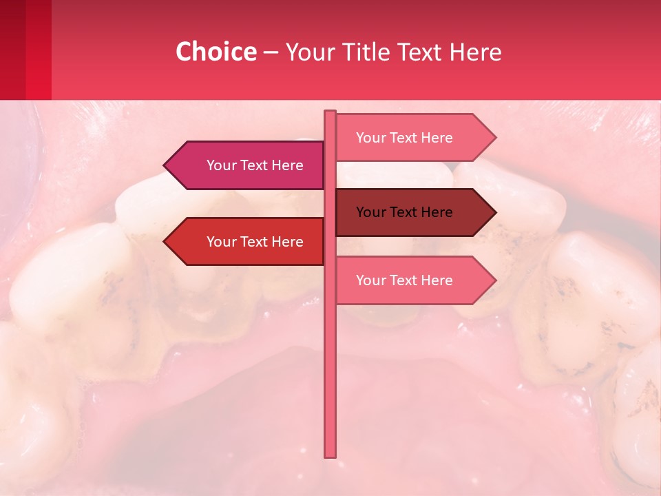 A Close Up Of A Tooth With Molds On It PowerPoint Template