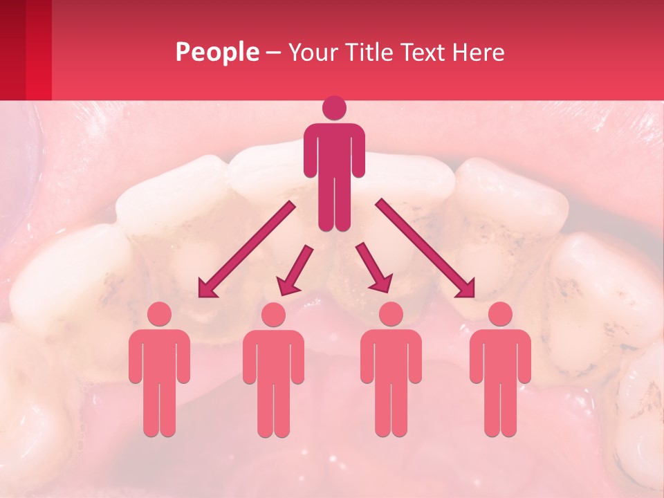 A Close Up Of A Tooth With Molds On It PowerPoint Template