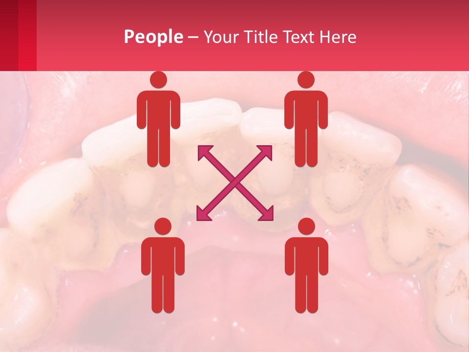 A Close Up Of A Tooth With Molds On It PowerPoint Template