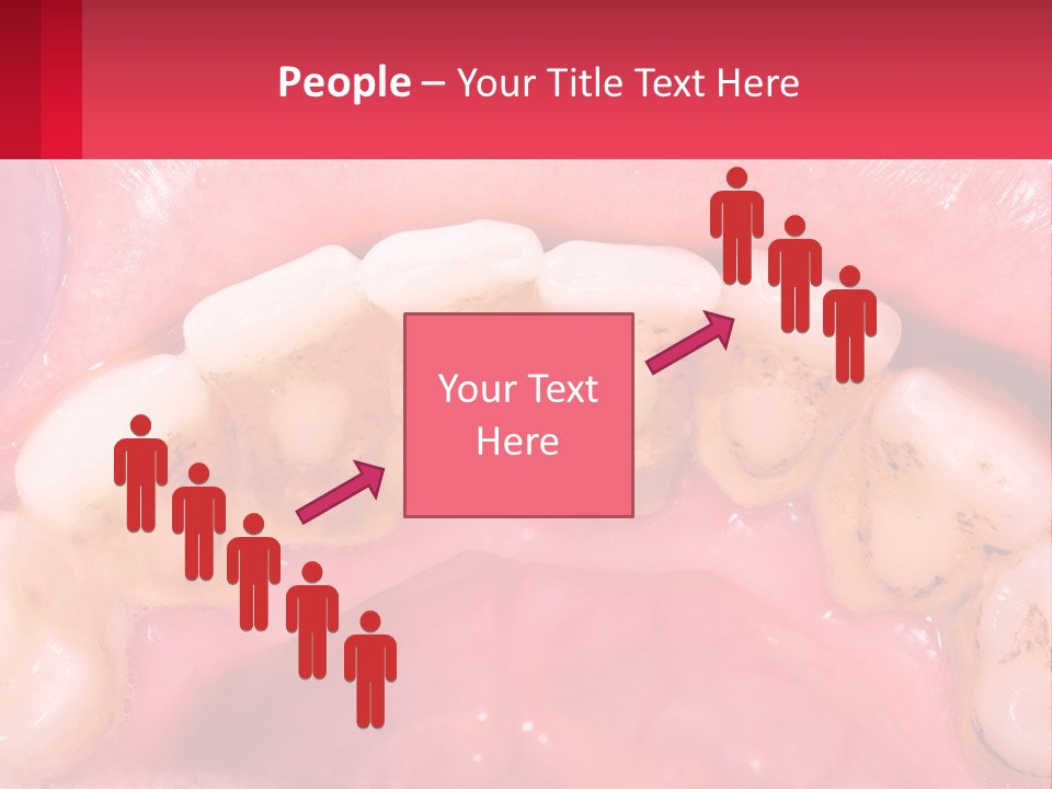 A Close Up Of A Tooth With Molds On It PowerPoint Template