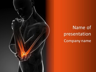 A Man Holding His Arm In Pain Powerpoint Presentation PowerPoint Template