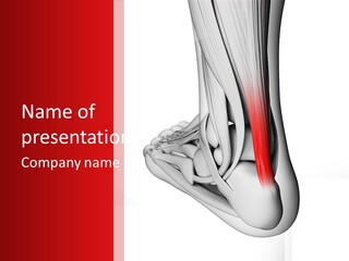 A Medical Powerpoint Presentation With A Picture Of A Foot PowerPoint Template