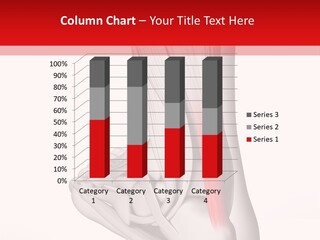 A Medical Powerpoint Presentation With A Picture Of A Foot PowerPoint Template