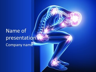 A 3D Image Of A Person With A Painful Knee PowerPoint Template