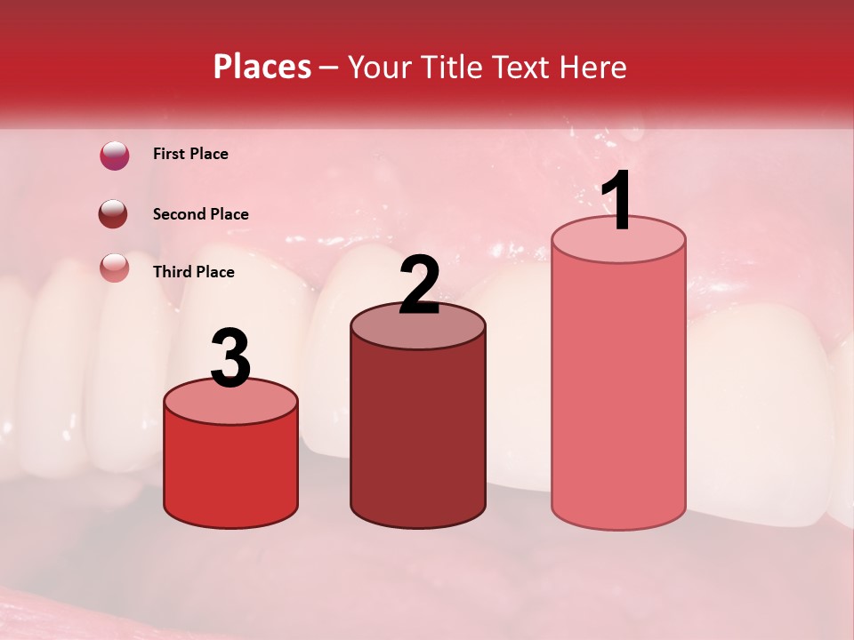 A Close Up Of A Tooth With A Plaque On It PowerPoint Template