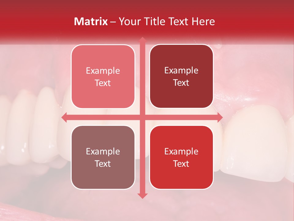 A Close Up Of A Tooth With A Plaque On It PowerPoint Template