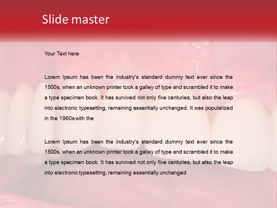 A Close Up Of A Tooth With A Plaque On It PowerPoint Template