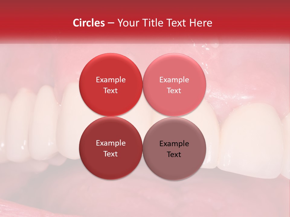 A Close Up Of A Tooth With A Plaque On It PowerPoint Template