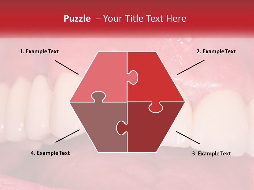 A Close Up Of A Tooth With A Plaque On It PowerPoint Template