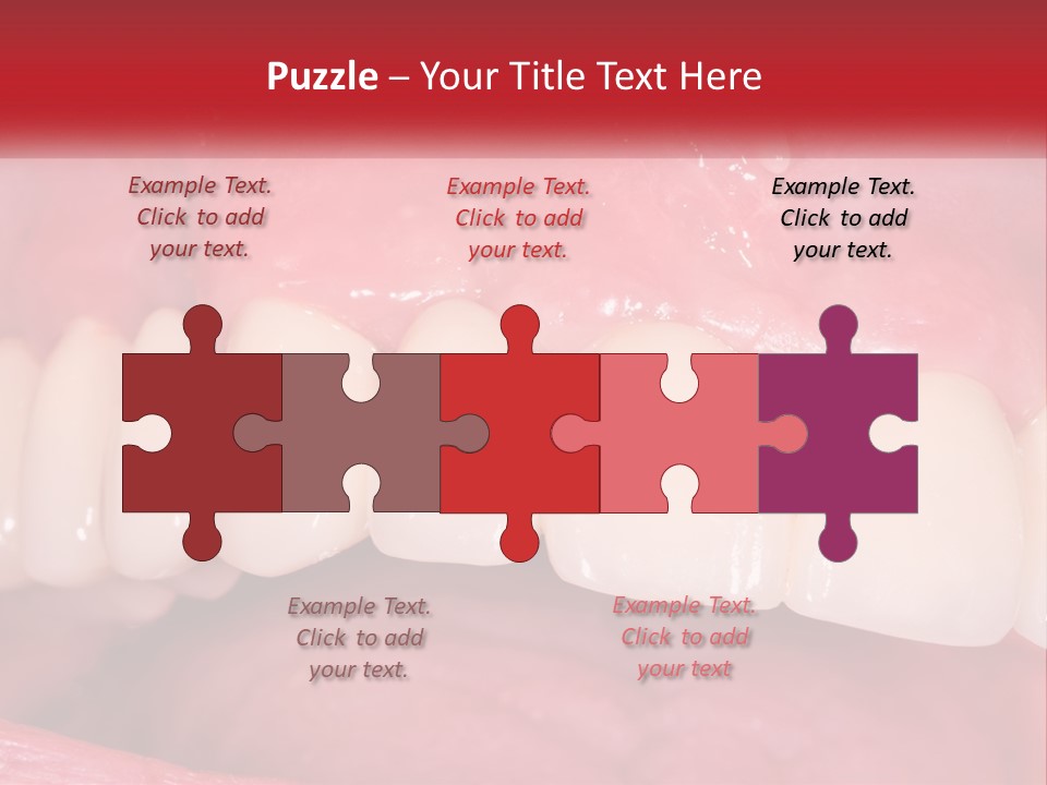 A Close Up Of A Tooth With A Plaque On It PowerPoint Template