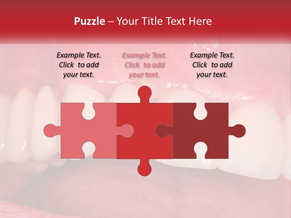 A Close Up Of A Tooth With A Plaque On It PowerPoint Template