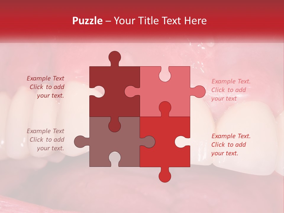 A Close Up Of A Tooth With A Plaque On It PowerPoint Template