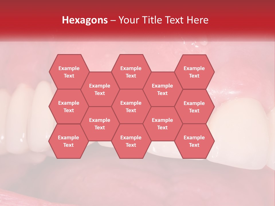 A Close Up Of A Tooth With A Plaque On It PowerPoint Template