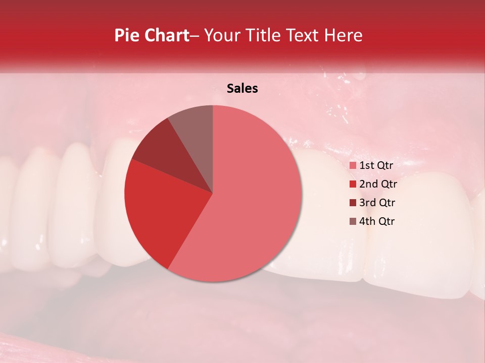 A Close Up Of A Tooth With A Plaque On It PowerPoint Template
