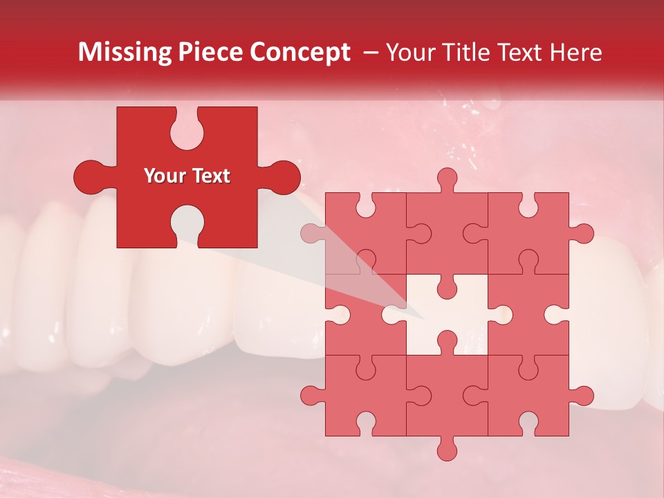 A Close Up Of A Tooth With A Plaque On It PowerPoint Template