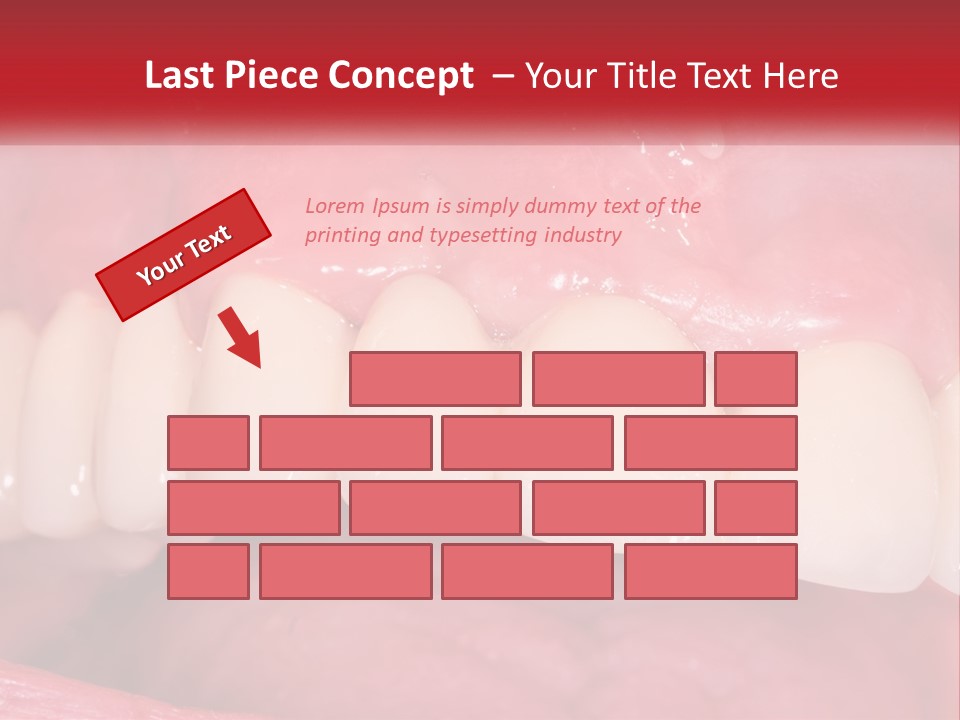 A Close Up Of A Tooth With A Plaque On It PowerPoint Template