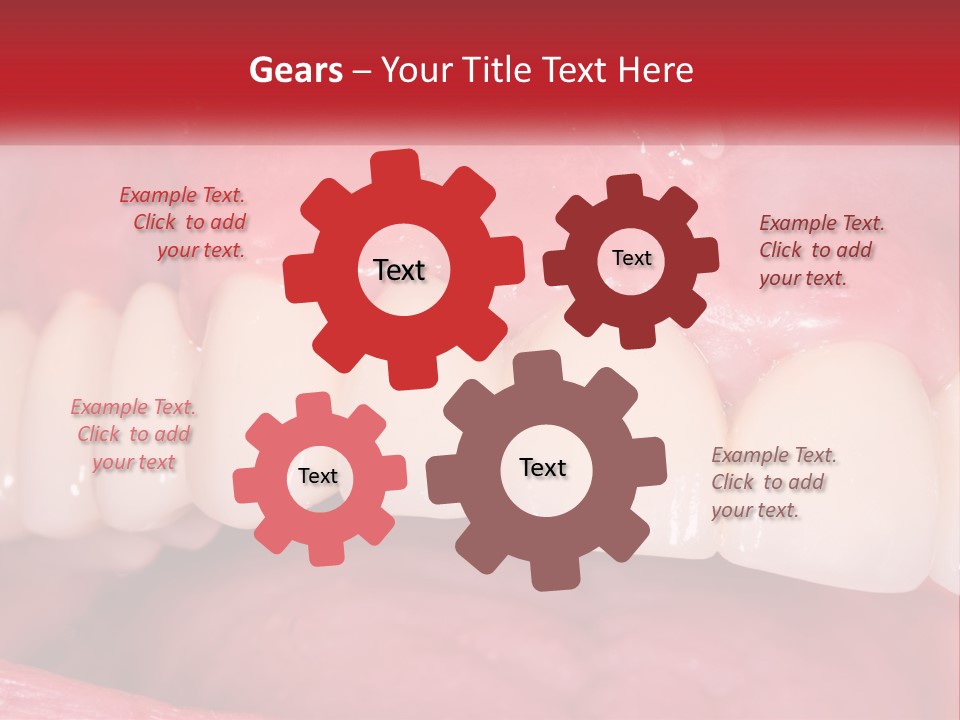 A Close Up Of A Tooth With A Plaque On It PowerPoint Template