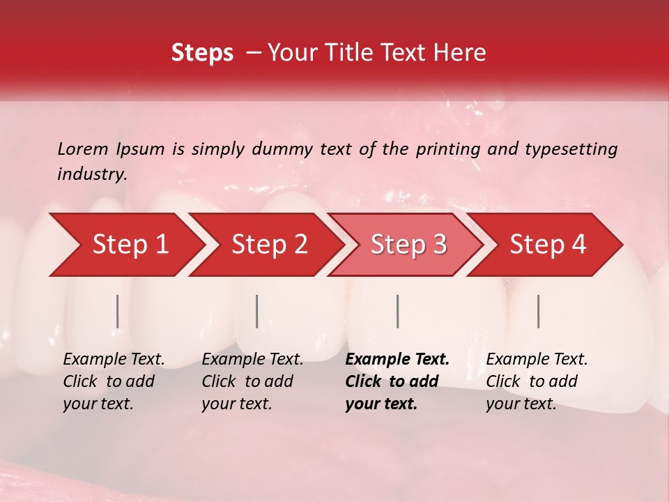 A Close Up Of A Tooth With A Plaque On It PowerPoint Template