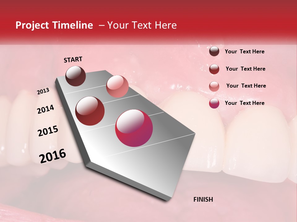 A Close Up Of A Tooth With A Plaque On It PowerPoint Template
