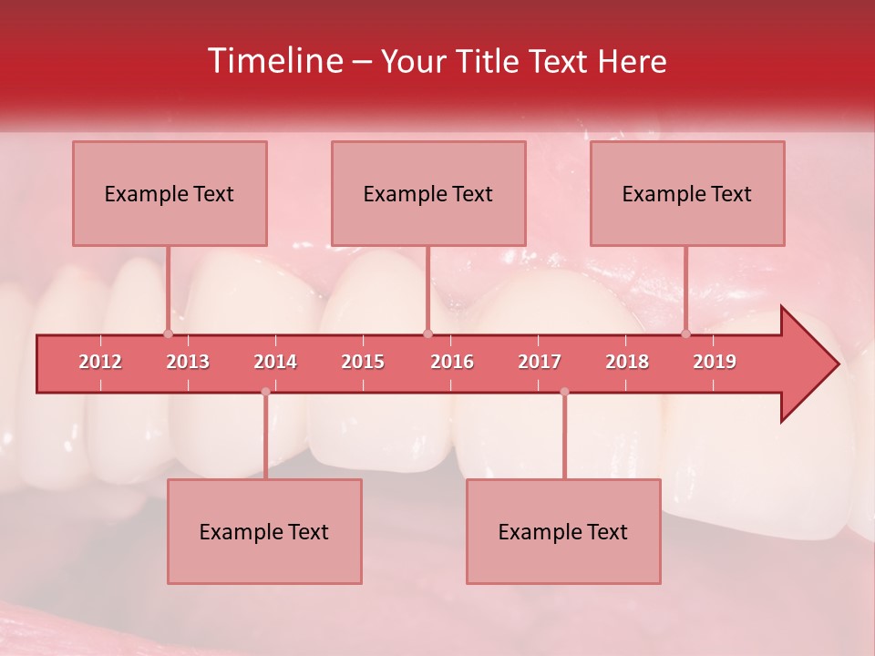 A Close Up Of A Tooth With A Plaque On It PowerPoint Template