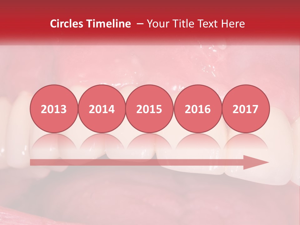 A Close Up Of A Tooth With A Plaque On It PowerPoint Template