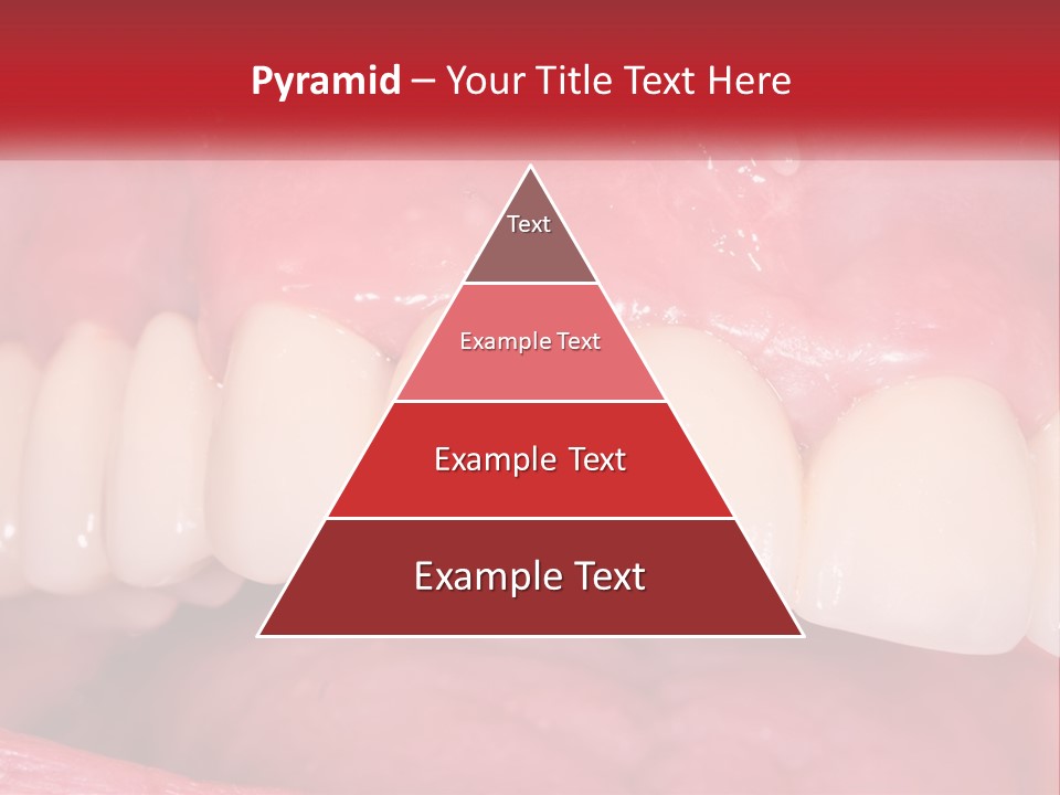 A Close Up Of A Tooth With A Plaque On It PowerPoint Template