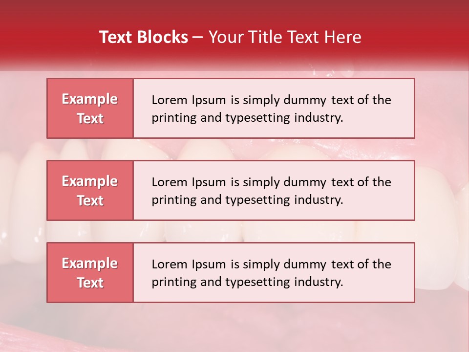 A Close Up Of A Tooth With A Plaque On It PowerPoint Template