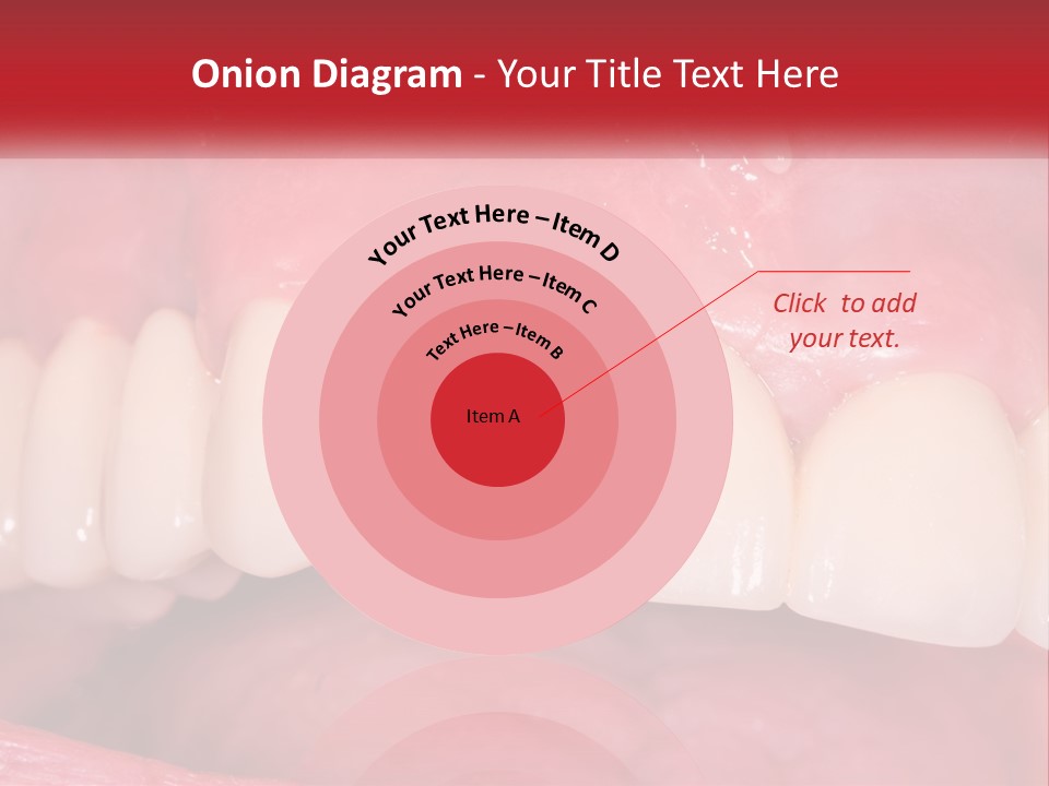 A Close Up Of A Tooth With A Plaque On It PowerPoint Template