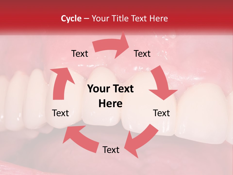 A Close Up Of A Tooth With A Plaque On It PowerPoint Template