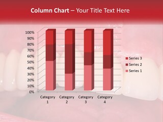 A Close Up Of A Tooth With A Plaque On It PowerPoint Template