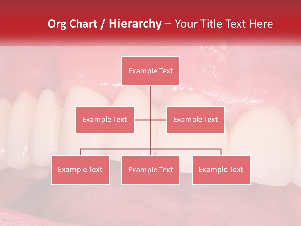A Close Up Of A Tooth With A Plaque On It PowerPoint Template