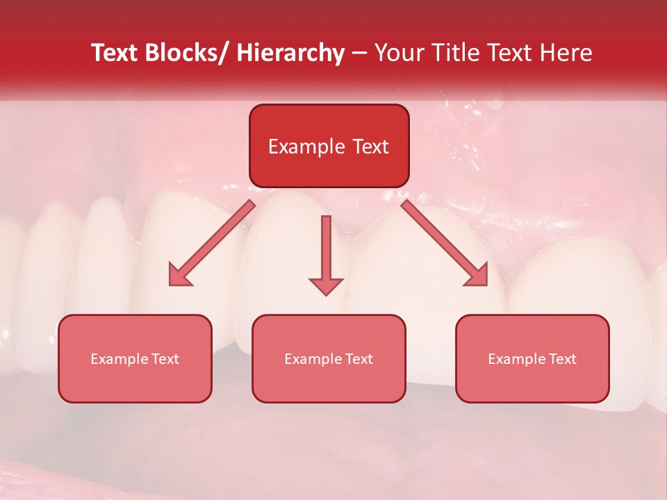 A Close Up Of A Tooth With A Plaque On It PowerPoint Template