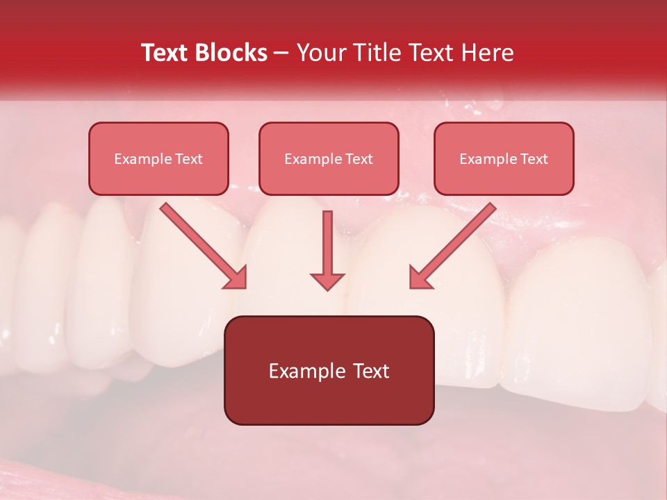 A Close Up Of A Tooth With A Plaque On It PowerPoint Template