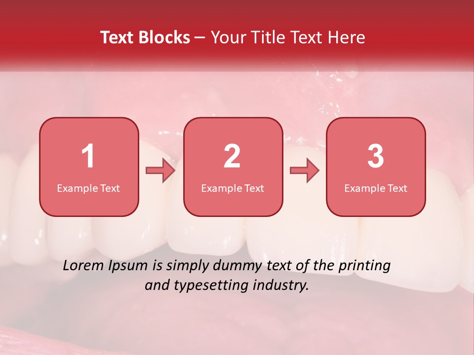 A Close Up Of A Tooth With A Plaque On It PowerPoint Template
