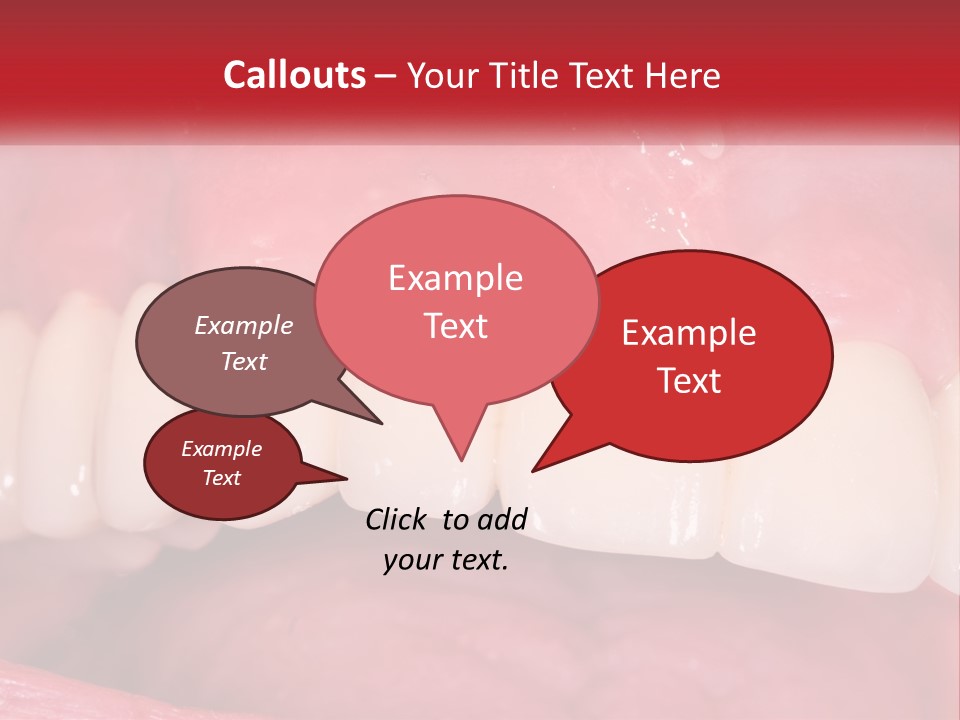 A Close Up Of A Tooth With A Plaque On It PowerPoint Template