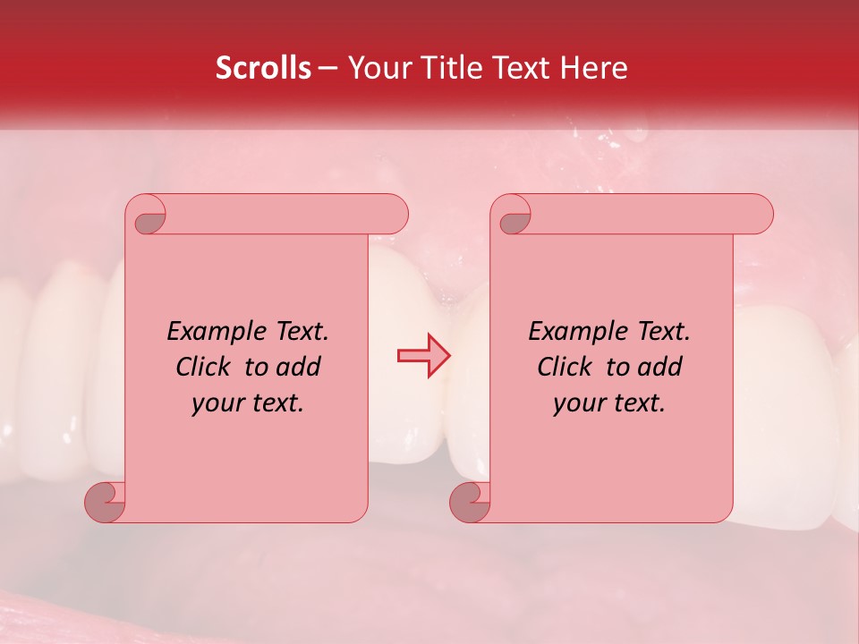 A Close Up Of A Tooth With A Plaque On It PowerPoint Template