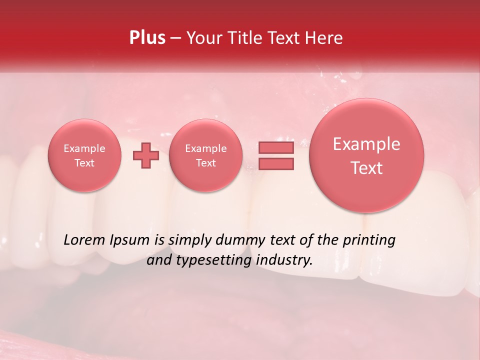 A Close Up Of A Tooth With A Plaque On It PowerPoint Template