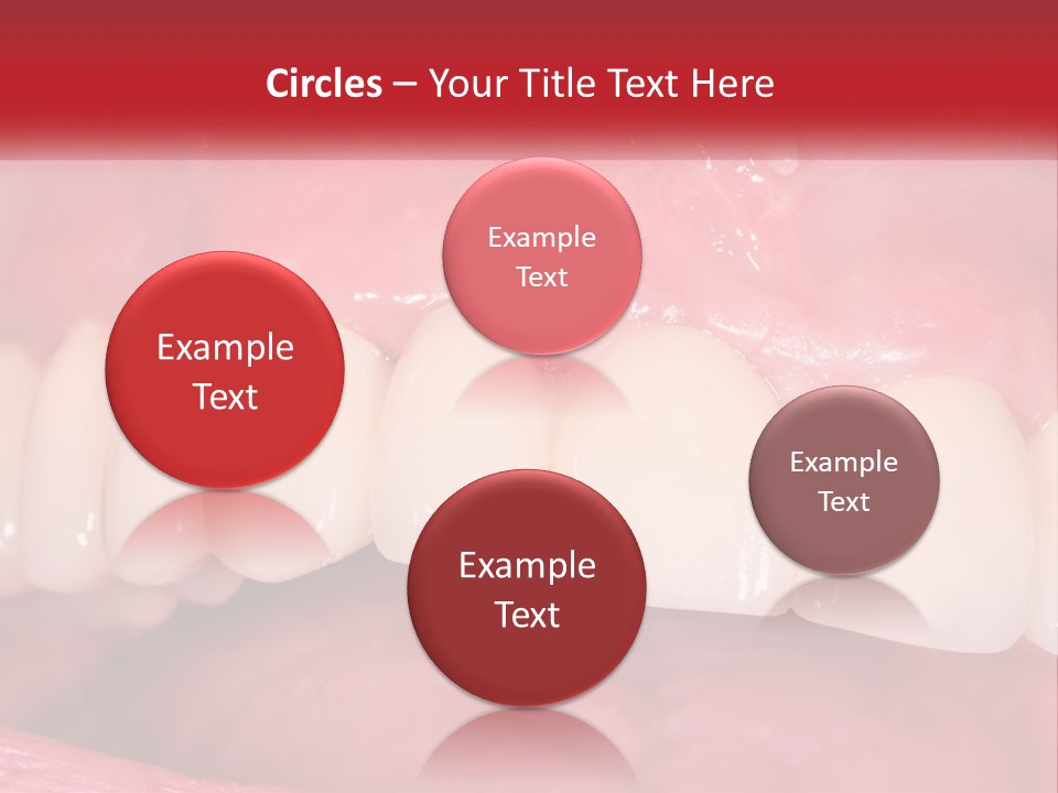 A Close Up Of A Tooth With A Plaque On It PowerPoint Template