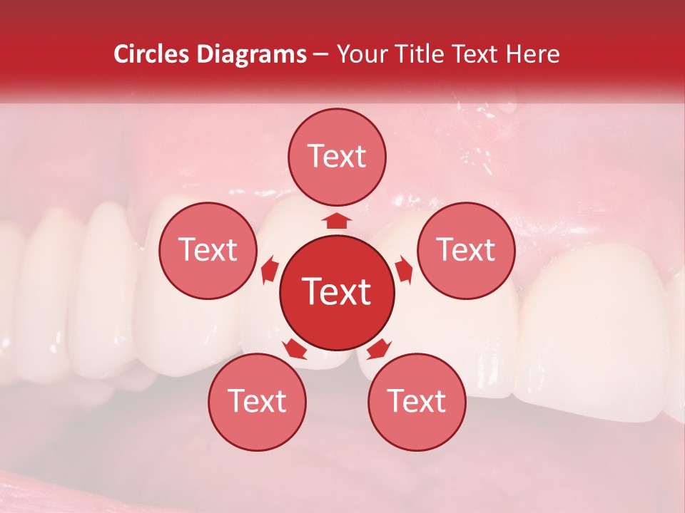 A Close Up Of A Tooth With A Plaque On It PowerPoint Template