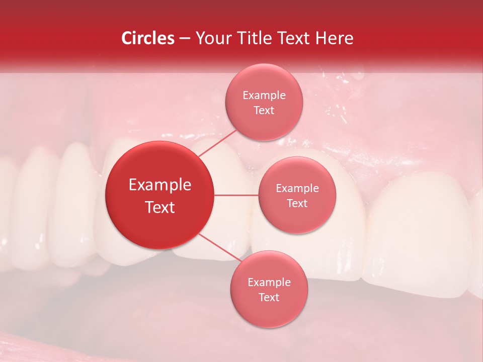 A Close Up Of A Tooth With A Plaque On It PowerPoint Template